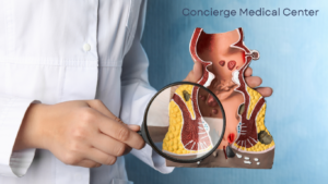 Anal fissür tıbbi çizimi, anal kanaldaki yırtığın yerini gösteriyor